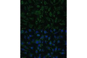 Immunofluorescence analysis of L929 cells using A Polyclonal Antibody (ABIN7265628) at dilution of 1:100 (40x lens).