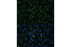 Immunofluorescence analysis of L929 cells using A Polyclonal Antibody (ABIN7265628) at dilution of 1:100 (40x lens). (APH1A anticorps  (C-Term))