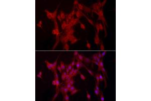 Immunofluorescence analysis of PC-12 cells using [KO Validated] PTPN2 Rabbit pAb (ABIN3022584, ABIN3022585, ABIN3022586, ABIN1513448 and ABIN6218927) at dilution of 1:250 (40x lens).