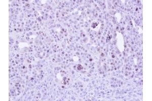 IHC-P Image Immunohistochemical analysis of paraffin-embedded NCIN87 xenograft , using ZC3H8, antibody at 1:500 dilution.