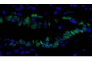 Immunofluorescence (IF) image for anti-Proliferating Cell Nuclear Antigen (PCNA) (C-Term) antibody (ABIN7448997) (PCNA anticorps  (C-Term))
