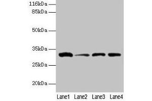 Western blot All lanes: GSTK1 antibody at 2 μg/mL Lane 1: 293T whole cell lysate Lane 2: Hela whole cell lysate Lane 3: A431 whole cell lysate Lane 4: COLO205 whole cell lysate Secondary Goat polyclonal to rabbit IgG at 1/10000 dilution Predicted band size: 26, 32, 25, 21 kDa Observed band size: 32 kDa (GSTK1 anticorps  (AA 2-226))