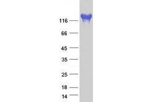 Validation with Western Blot