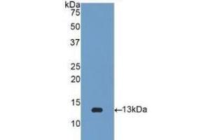 Detection of Recombinant b2M, Human using Polyclonal Antibody to Beta-2-Microglobulin (b2M) (beta-2 Microglobulin anticorps  (AA 22-119))