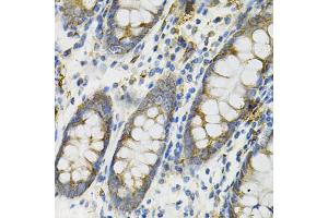 Immunohistochemistry of paraffin-embedded human colon using DEFB132 antibody (ABIN6293281) at dilution of 1:100 (40x lens). (DEFB132 anticorps)