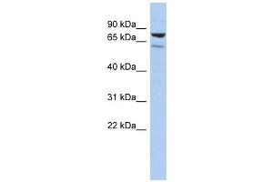 C1ORF103 antibody used at 1 ug/ml to detect target protein. (C1orf103 anticorps  (Middle Region))