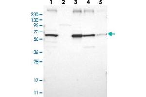 Western blot analysis of Lane 1: RT-4, Lane 2: Human Plasma, Lane 3: U-251 MG, Lane 4: Liver, Lane 5: Tonsil with CLCC1 polyclonal antibody  at 1:250-1:500 dilution. (CLCC1 anticorps)