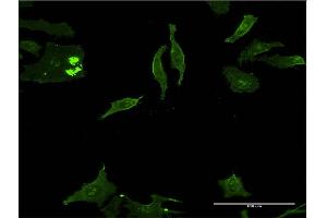 Immunofluorescence of monoclonal antibody to DLX5 on HeLa cell.