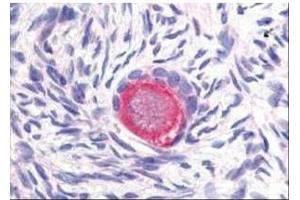 Affinity Purified anti-Delta-4 antibody was used at 20 µg/ml to detect Delta-4 in a variety of tissues including colon, liver, skeletal muscle, ovary, pancreas, prostate, testes, thymus, tonsil and uterus.