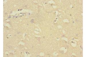 Immunohistochemistry of paraffin-embedded human brain tissue using ABIN7154473 at dilution of 1:100