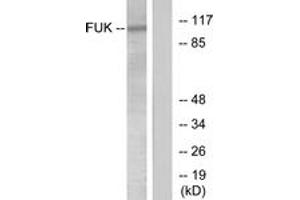 Western blot analysis of extracts from COS7 cells, treated with insulin 0. (FUK anticorps  (AA 11-60))