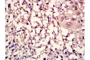 anti-Melanocortin 5 Receptor (MC5R) (AA 78-125) antibody