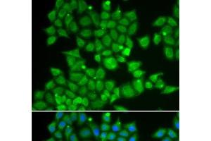 Immunofluorescence analysis of U2OS cells using PDE1B Polyclonal Antibody (PDE1B anticorps)