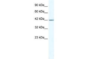 WB Suggested Anti-ZNF70 Antibody Titration:  5. (ZNF70 anticorps  (N-Term))