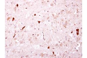 IHC-P Image BTD antibody [N3C3] detects BTD protein at cytosol on mouse hind brain by immunohistochemical analysis. (BTD anticorps)