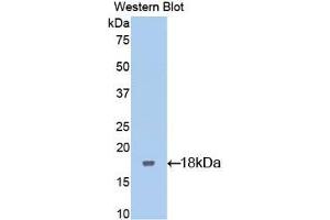 Western blot analysis of the recombinant protein. (LIFR anticorps  (AA 151-290))