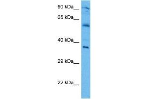 Host:  Mouse  Target Name:  IRF1  Sample Tissue:  Mouse Brain  Antibody Dilution:  1ug/ml (IRF1 anticorps  (Middle Region))