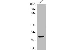 Western Blot analysis of HeLa cells using Cleaved-Cathepsin L1 HC (T288) Polyclonal Antibody (Cathepsin L anticorps  (Cleaved-Thr288))