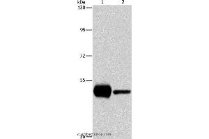Western blot analysis of K562 and mouse brain tissue, using PIP4K2A Polyclonal Antibody at dilution of 1:1150 (PIP4K2A anticorps)