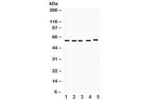 Western blot testing of 1) rat liver, 2) mouse liver, 3) rat kidney, 4) mouse kidney, 5) human SMMC lysate with FMO1 antibody.