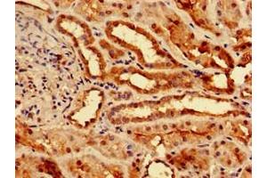 Immunohistochemistry of paraffin-embedded human kidney tissue using ABIN7173369 at dilution of 1:100 (Slc25a1 anticorps  (AA 144-182))