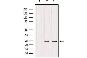 Western blot analysis of extracts from various samples, using RAB6A Antibody. (RAB6A anticorps  (Internal Region))