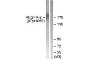 Western blot analysis of extracts from HepG2 cells treated with Na3VO4 0. (VEGFR2/CD309 anticorps  (pTyr1059))