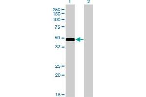 Western Blot analysis of CRLF1 expression in transfected 293T cell line by CRLF1 monoclonal antibody (M01), clone 4F4. (CRLF1 anticorps  (AA 135-230))