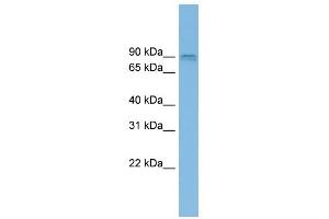 CENTG1 antibody used at 1 ug/ml to detect target protein. (AGAP2 anticorps  (Middle Region))