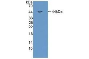 Detection of Recombinant RB1, Human using Polyclonal Antibody to Retinoblastoma Protein 1 (RB1)