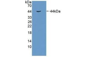 Detection of Recombinant RB1, Human using Polyclonal Antibody to Retinoblastoma Protein 1 (RB1) (Retinoblastoma 1 anticorps  (AA 639-778))