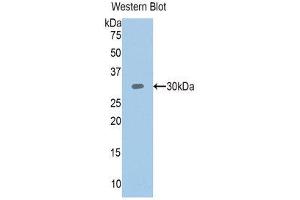 Western Blotting (WB) image for anti-Plastin 3 (PLS3) (AA 379-630) antibody (ABIN1111126) (Plastin 3 anticorps  (AA 379-630))