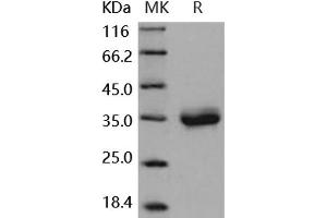 Western Blotting (WB) image for Coxsackie Virus and Adenovirus Receptor (CXADR) (Active) protein (His tag) (ABIN7320434)