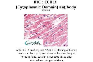 Image no. 1 for anti-Chemokine (C-C Motif) Receptor-Like 1 (CCRL1) (1st Cytoplasmic Domain) antibody (ABIN1732790) (CCRL1 anticorps  (1st Cytoplasmic Domain))
