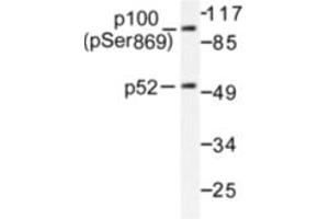 Image no. 1 for anti-Nuclear Factor of kappa Light Polypeptide Gene Enhancer in B-Cells 2 (NFKB2) (pSer869) antibody (ABIN318077) (NFKB2 anticorps  (pSer869))
