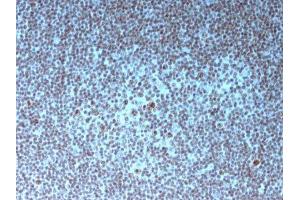 Image no. 3 for anti-Nucleolar / Nucleoli antibody (ABIN6153718) (Nucleolar / Nucleoli anticorps)