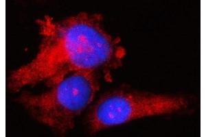 IF analysis of RPS17 using anti-RPS17 antibody (ABIN7598984). (RPS17 anticorps  (AA 1-135))