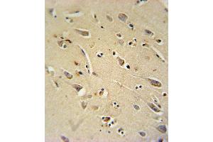 anti-Ras Homolog Gene Family, Member Q (RHOQ) (AA 48-76) antibody