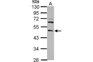 WB Image Sample (30 ug of whole cell lysate) A: PC-3 10% SDS PAGE antibody diluted at 1:1000 (DP2 anticorps)