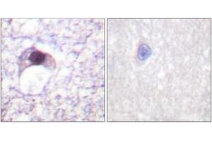 Immunohistochemistry analysis of paraffin-embedded human brain tissue, using E2F6 Antibody.