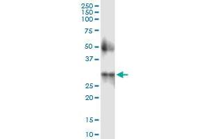 anti-Cell Death-Inducing DFFA-Like Effector A (CIDEA) (AA 1-253) antibody