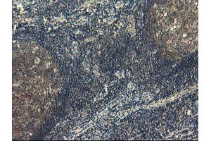 Image no. 3 for anti-Copper Metabolism (Murr1) Domain Containing 1 (COMMD1) antibody (ABIN1497561)