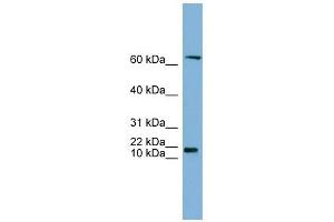 GM2A antibody used at 1 ug/ml to detect target protein. (GM2A anticorps  (N-Term))