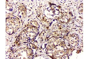 IHC analysis of GPX1 using anti GPX1 antibody (ABIN6719520). (Glutathione Peroxidase 1 anticorps  (Middle Region))