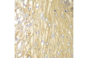 Immunohistochemistry of paraffin-embedded human esophagus using PPP2R2A antibody (ABIN5971211) at dilution of 1/100 (40x lens). (PPP2R2A anticorps)