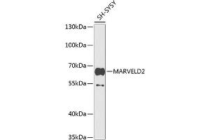 Western blot analysis of extracts of SH-SY5Y cells, using M antibody (ABIN6133958, ABIN6143567, ABIN6143569 and ABIN6224825) at 1:1000 dilution. (Tricellulin anticorps  (AA 200-300))