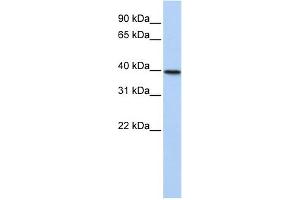 WB Suggested Anti-TIA1 Antibody Titration:  0. (TIA1 anticorps  (N-Term))
