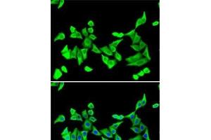 Immunofluorescence analysis of U2OS cells using PTH Polyclonal Antibody (PTH anticorps)