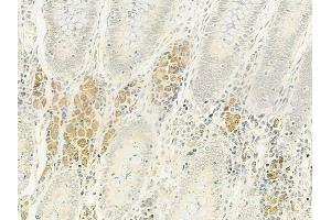 ABIN6264305 and ABIN6272862 at 1/100 staining human normal colon tissue by IHC-P. (PLOD2 anticorps  (C-Term))