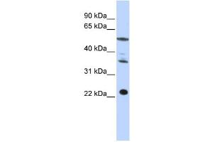Western Blotting (WB) image for anti-Centromere Protein M (CENPM) antibody (ABIN2459009) (CENPM anticorps)